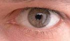 Wechselwirkung von
                                                  Strahlung mit Haut
                                                  und Augen hängt von
                                                  der Wellenlänge
                                                  ab