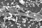 Les bactéries qui se développent sous forme de biofilm peuvent
								survivre dans un environnement hostile. 